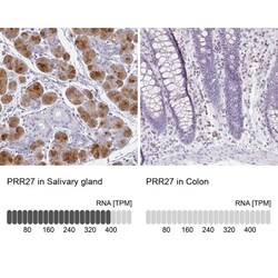 PRR27 Antibody, Novus Biologicals 0.1mL; Unlabeled:Antibodies, Polyclonal